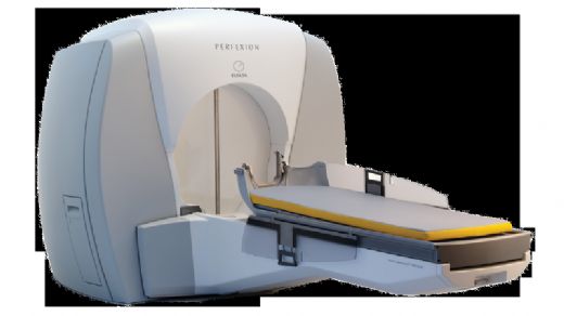 Gamma Knife Yan Etkileri