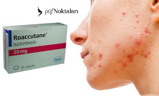 Roaccutane Yan Etkileri